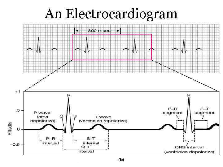 An Electrocardiogram 