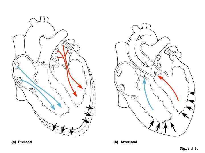 Preload and Afterload Figure 18. 21 