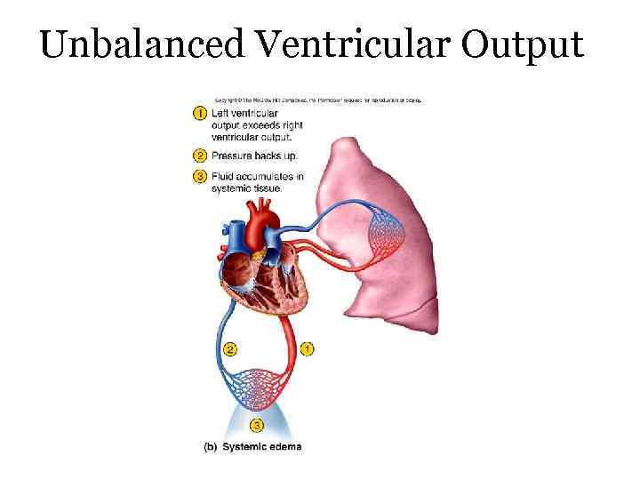 Unbalanced Ventricular Output 