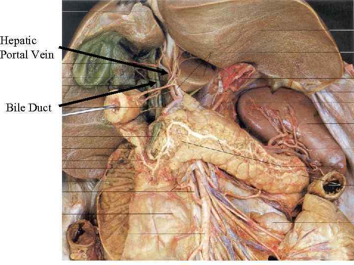 Hepatic Portal Vein Bile Duct 