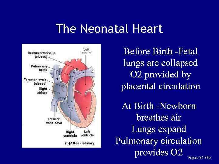 The Neonatal Heart Before Birth -Fetal lungs are collapsed O 2 provided by placental