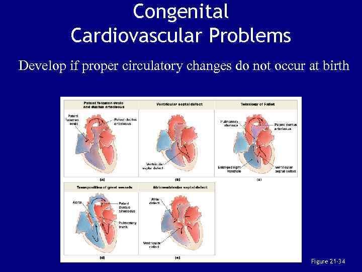 Congenital Cardiovascular Problems Develop if proper circulatory changes do not occur at birth Figure