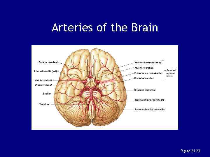 Arteries of the Brain Figure 21 -23 