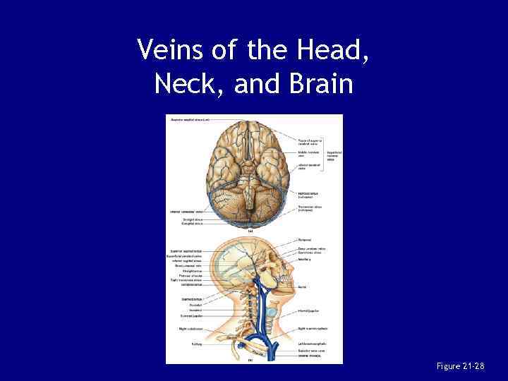 Veins of the Head, Neck, and Brain Figure 21 -28 