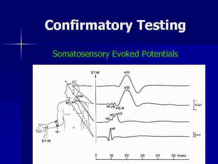 Confirmatory Testing Somatosensory Evoked Potentials 