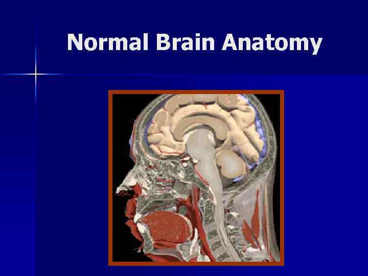 Normal Brain Anatomy 