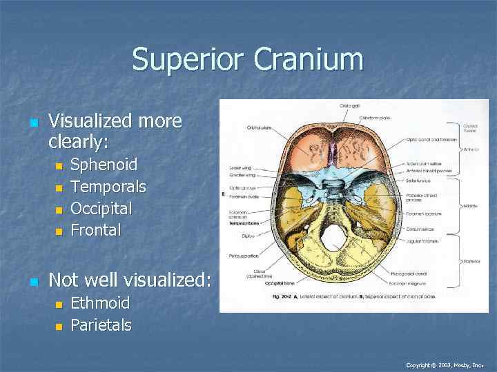 Superior Cranium n Visualized more clearly: n n n Sphenoid Temporals Occipital Frontal Not