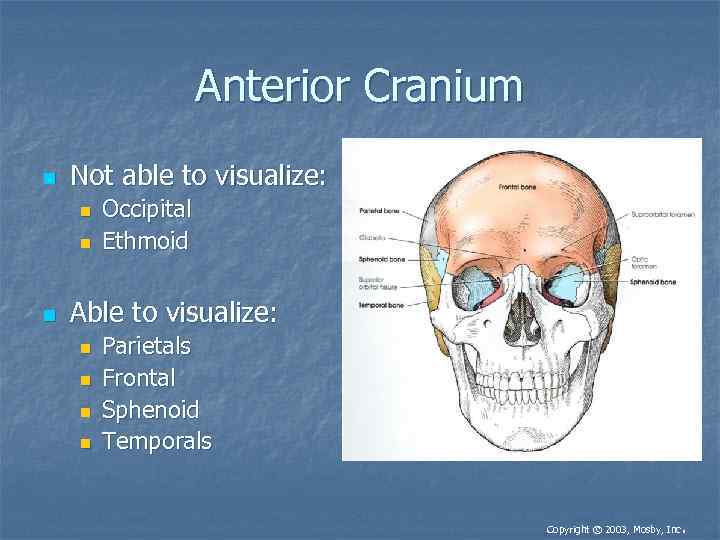 Anterior Cranium n Not able to visualize: n n n Occipital Ethmoid Able to