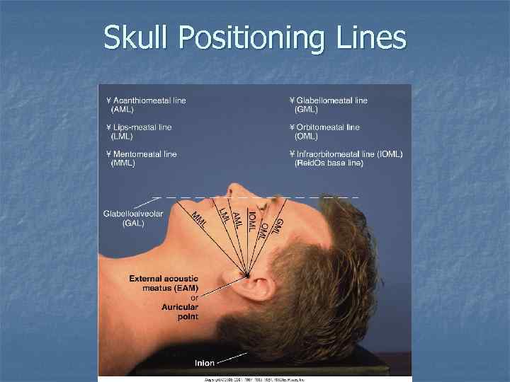 Skull Positioning Lines 