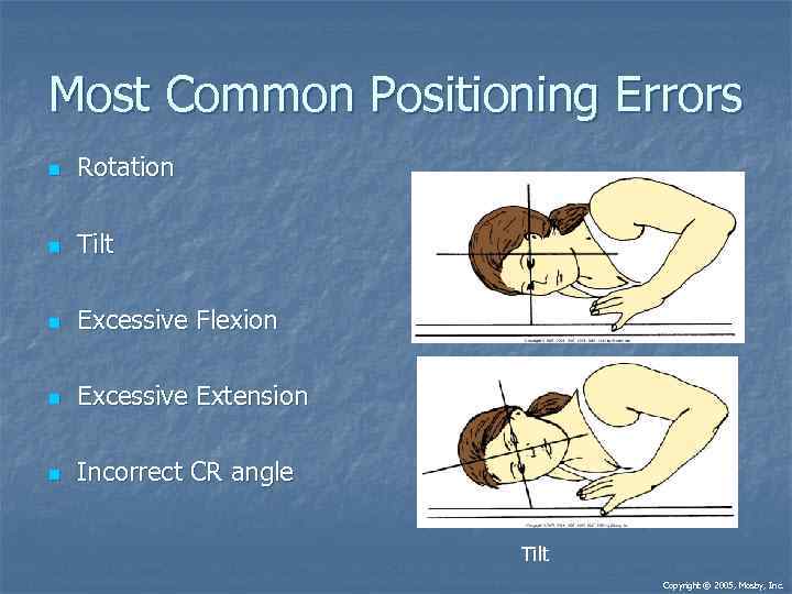 Most Common Positioning Errors n Rotation n Tilt n Excessive Flexion n Excessive Extension