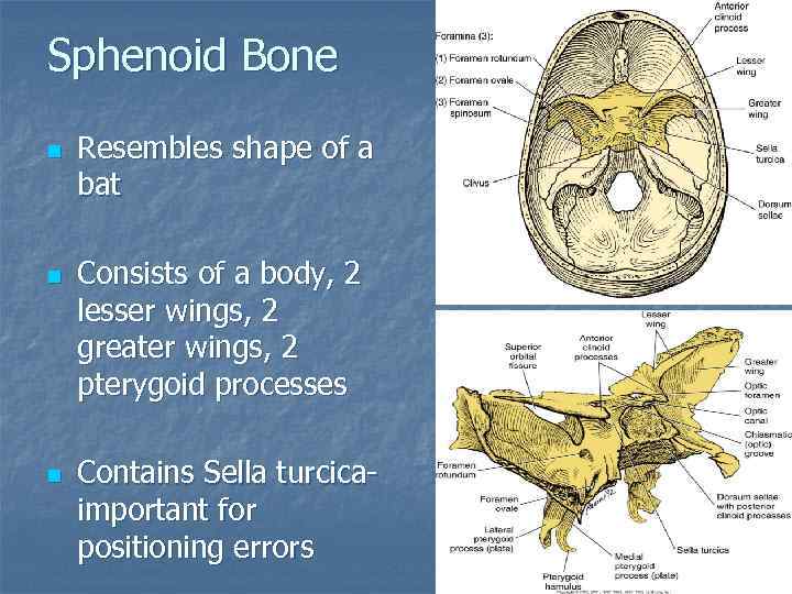 Sphenoid Bone n n n Resembles shape of a bat Consists of a body,