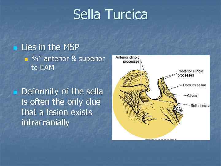 Sella Turcica n Lies in the MSP n n ¾” anterior & superior to