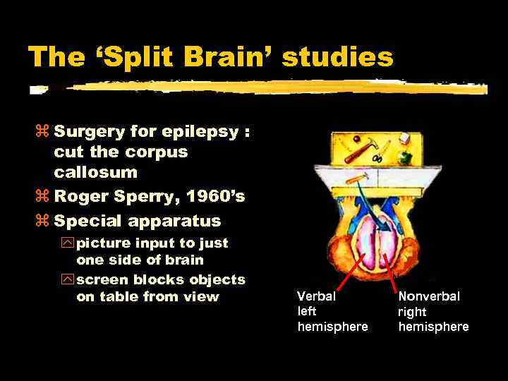 The ‘Split Brain’ studies Surgery for epilepsy : cut the corpus callosum Roger Sperry,