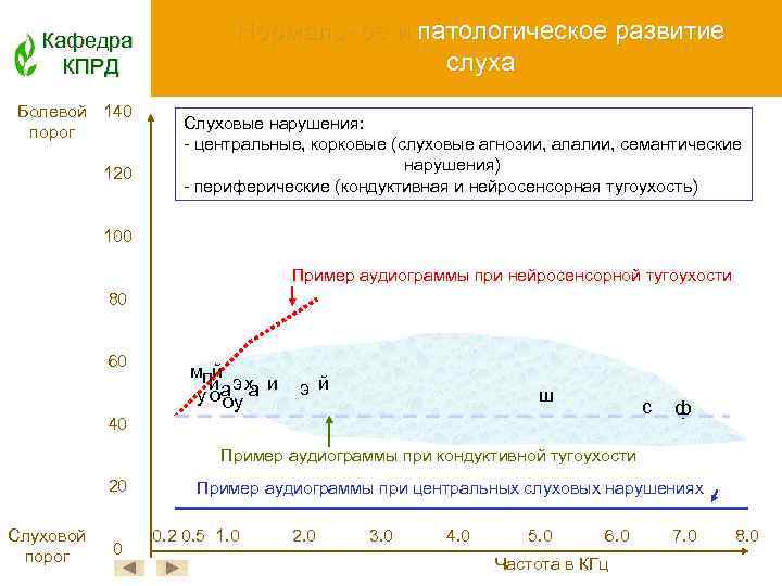 Кафедра КПРД Болевой 140 порог 120 Нормальное и патологическое развитие слуха Слуховые нарушения: -