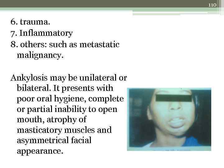 110 6. trauma. 7. Inflammatory 8. others: such as metastatic malignancy. Ankylosis may be