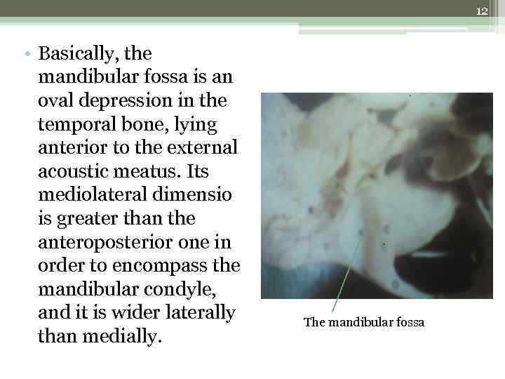 12 • Basically, the mandibular fossa is an oval depression in the temporal bone,
