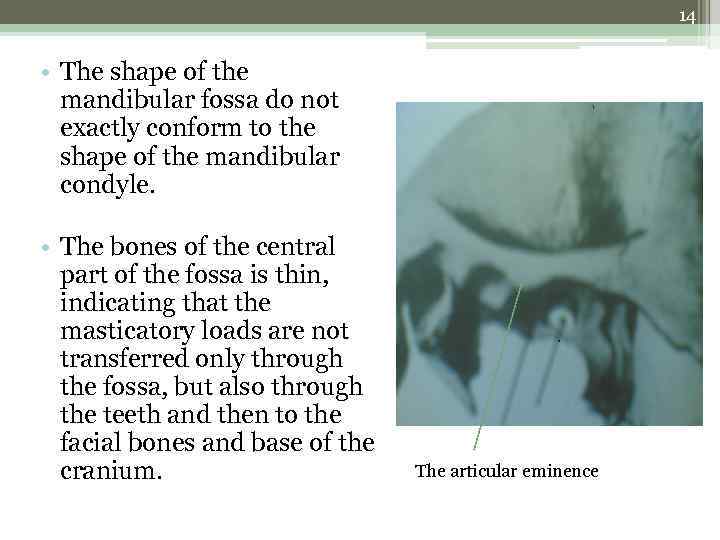 14 • The shape of the mandibular fossa do not exactly conform to the