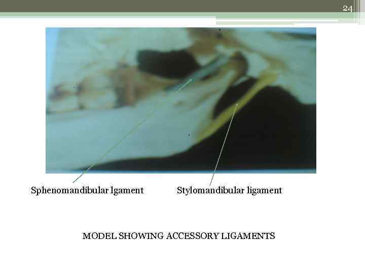 24 Sphenomandibular lgament Stylomandibular ligament MODEL SHOWING ACCESSORY LIGAMENTS 