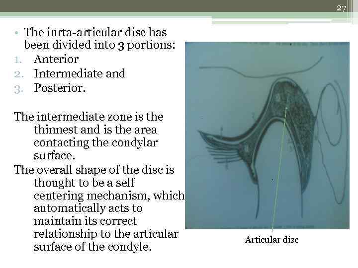 27 • The inrta-articular disc has been divided into 3 portions: 1. Anterior 2.