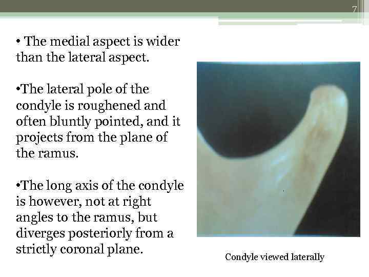 7 • The medial aspect is wider than the lateral aspect. • The lateral