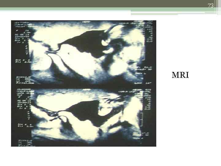 73 MRI 