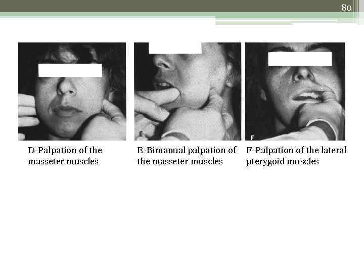 80 D-Palpation of the masseter muscles E-Bimanual palpation of the masseter muscles F-Palpation of
