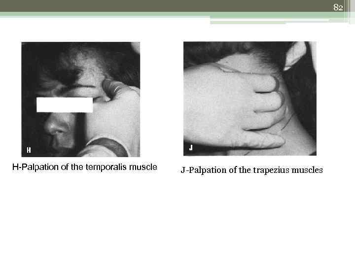82 H-Palpation of the temporalis muscle J-Palpation of the trapezius muscles 