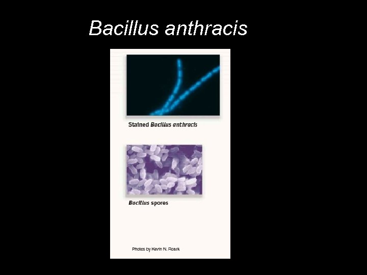 Bacillus anthracis 