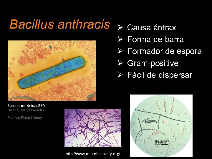 Bacillus anthracis Ø Ø Ø Bacteria de ántrax SEM: CAMR, Barry Dowsett / Science