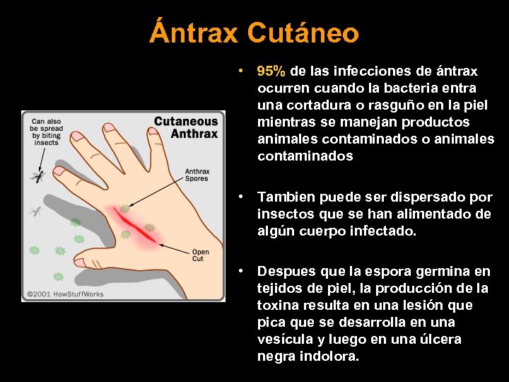 Ántrax Cutáneo • 95% de las infecciones de ántrax ocurren cuando la bacteria entra