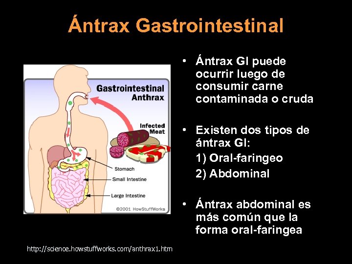 Ántrax Gastrointestinal • Ántrax GI puede ocurrir luego de consumir carne contaminada o cruda