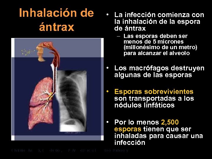 Inhalación de ántrax • La infección comienza con la inhalación de la espora de