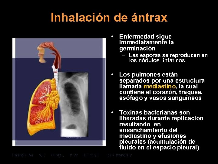 Inhalación de ántrax • Enfermedad sigue immediatamente la germinación – Las esporas se reproducen