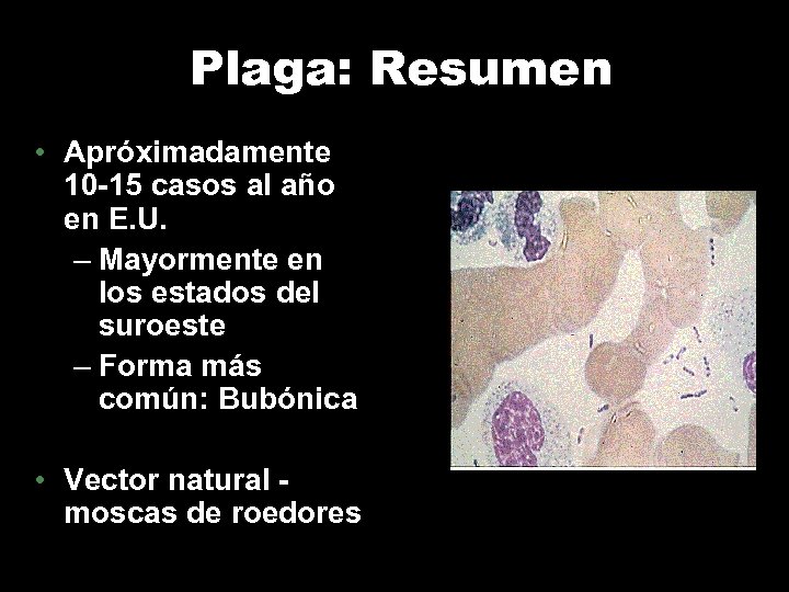 Plaga: Resumen • Apróximadamente 10 -15 casos al año en E. U. – Mayormente