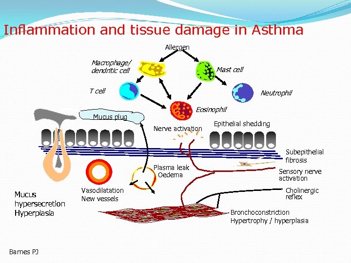 Inflammation and tissue damage in Asthma Allergen Macrophage/ dendritic cell Mast cell T cell