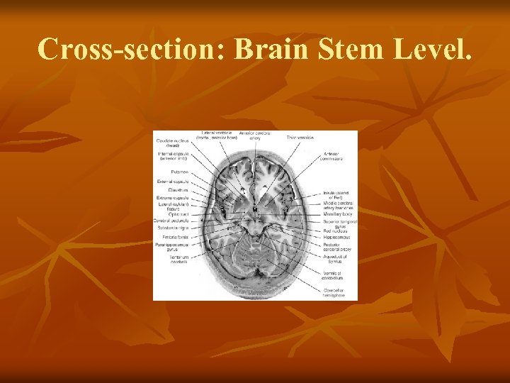 Cross-section: Brain Stem Level. 