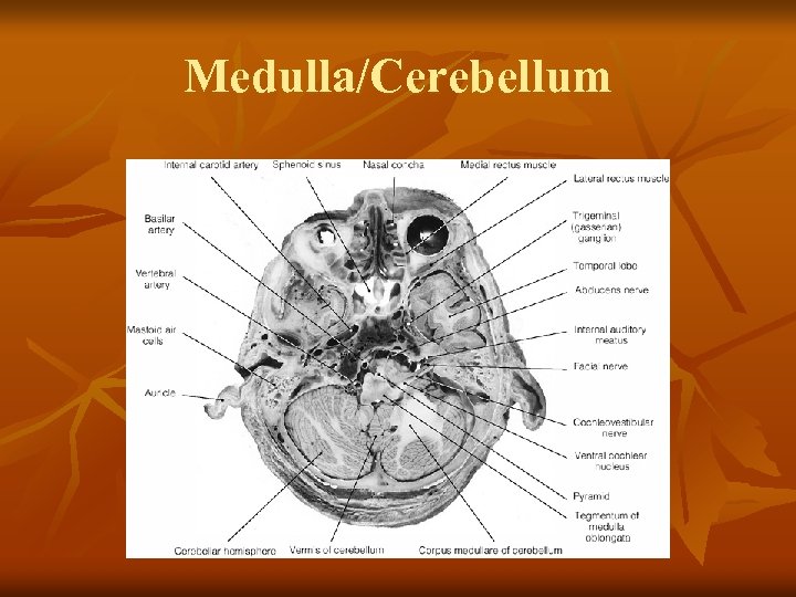 Medulla/Cerebellum 