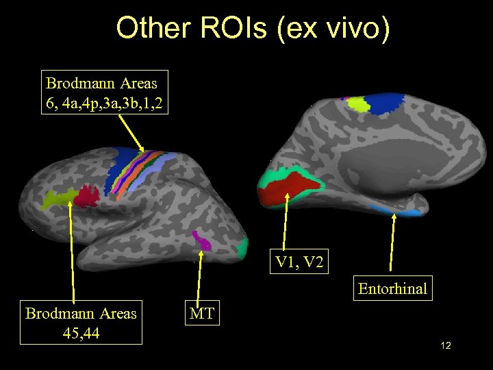 Other ROIs (ex vivo) Brodmann Areas 6, 4 a, 4 p, 3 a, 3