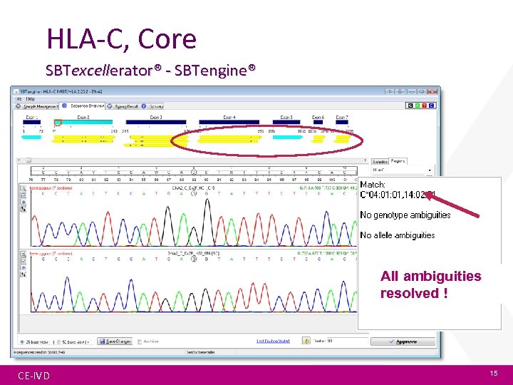 HLA-C, Core + Extended SBTexcellerator® - SBTengine® All ambiguities resolved ! CE-IVD 15 