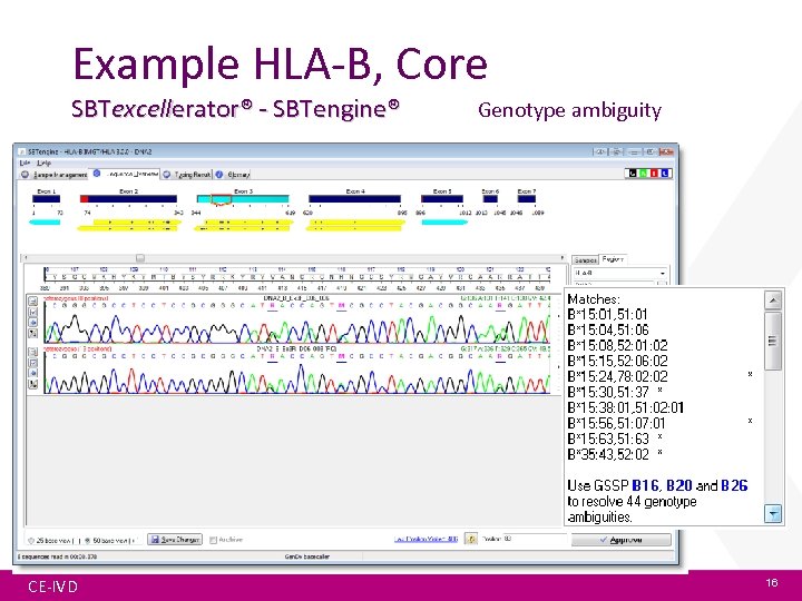 Example HLA-B, Core SBTexcellerator® - SBTengine® CE-IVD Genotype ambiguity 16 