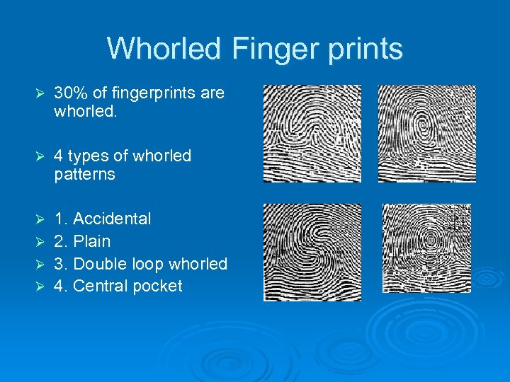 Whorled Finger prints Ø 30% of fingerprints are whorled. Ø 4 types of whorled
