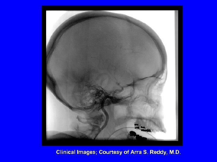 Clinical Images; Courtesy of Arra S. Reddy, M. D. 