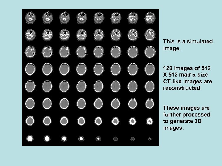 This is a simulated image. 128 images of 512 X 512 matrix size CT-like