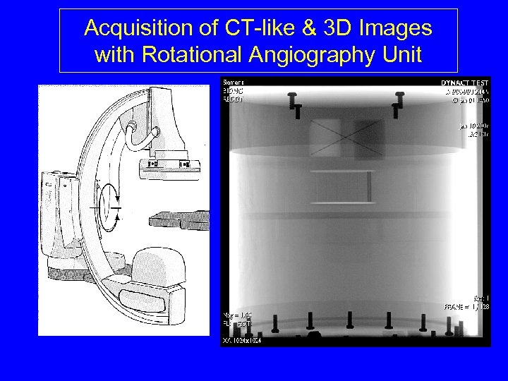 Acquisition of CT-like & 3 D Images with Rotational Angiography Unit 