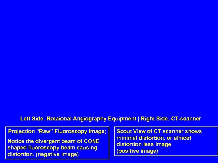 Left Side: Rotaional Angiography Equipment | Right Side: CT-scanner Projection “Raw” Fluoroscopy Image; Notice