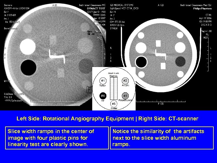 Left Side: Rotational Angiography Equipment | Right Side: CT-scanner Slice width ramps in the