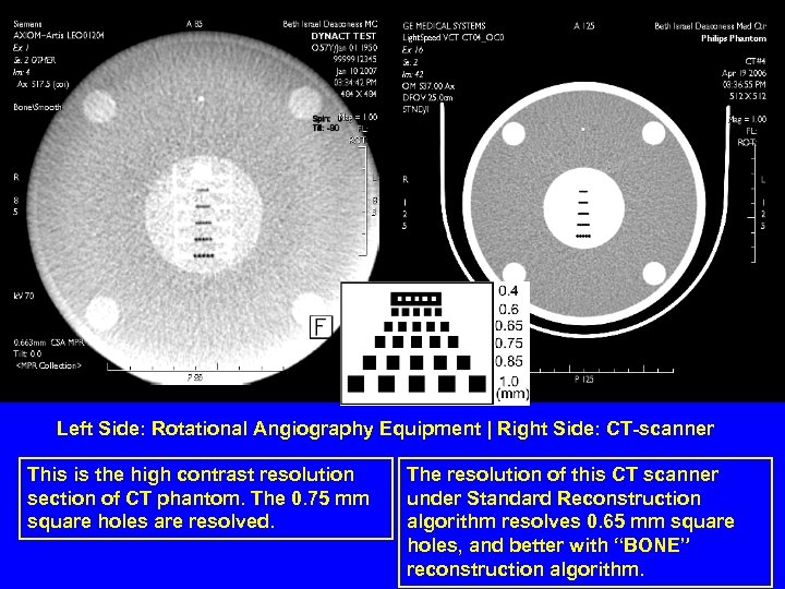 Left Side: Rotational Angiography Equipment | Right Side: CT-scanner This is the high contrast