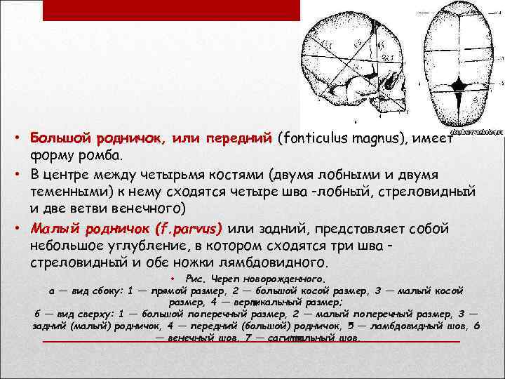  • Большой родничок, или передний (fonticulus magnus), имеет форму ромба. • В центре