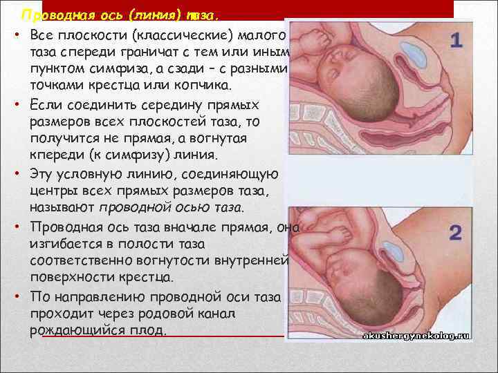 Проводная ось (линия) таза. • Все плоскости (классические) малого таза спереди граничат с тем