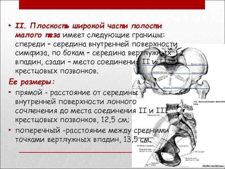  • II. Плоскость широкой части полости малого таза имеет следующие границы: спереди –